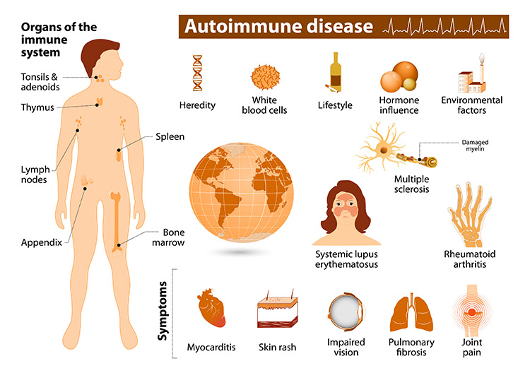 Autoimmune Diseases: Types, Causes & Treatment