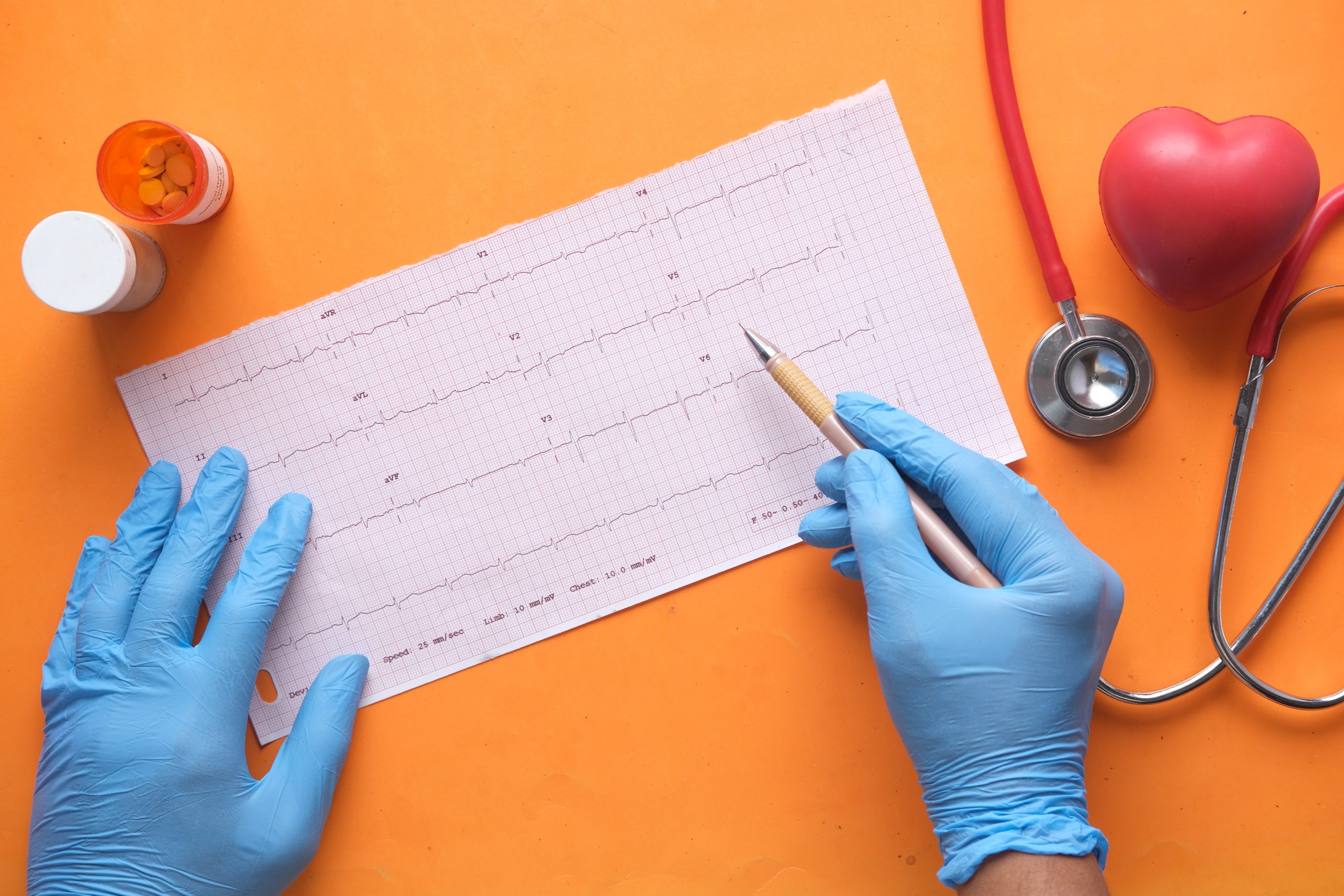 What is Electrophysiology & Its Relation to Heart Health?